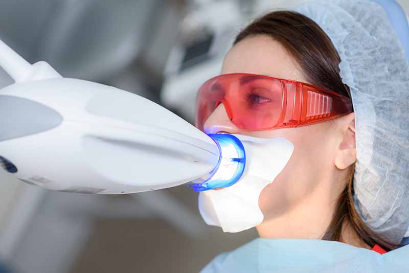 melhores-dentistas-para-clareamento-dental-em-bh