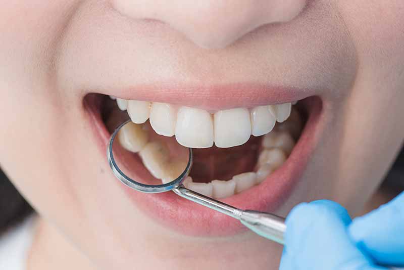 tratamento-de-dentes-com-melhor-preço-em-bh-e-regiao-metropolitana